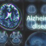 New Risk Factors for Alzheimer's Revealed