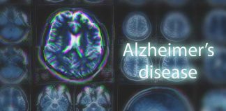 New Risk Factors for Alzheimer's Revealed