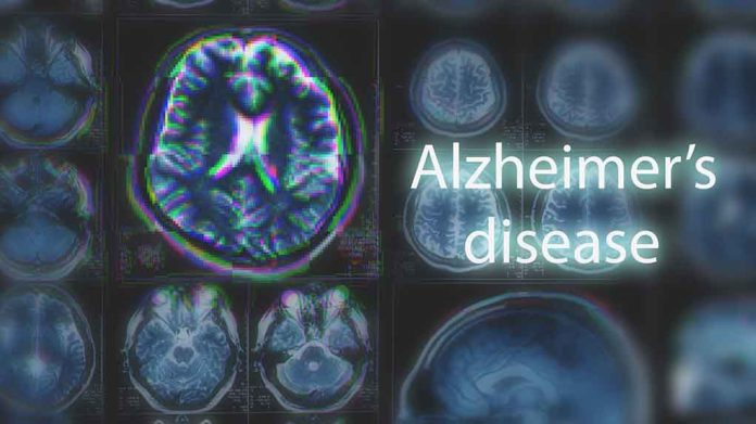New Risk Factors for Alzheimer's Revealed